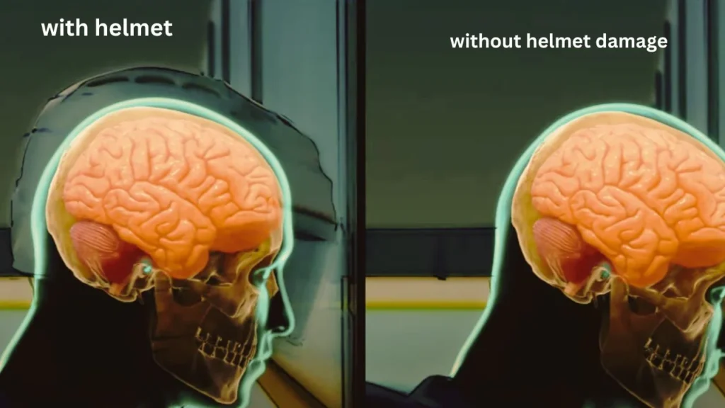 Impact of Riding Without a Helmet